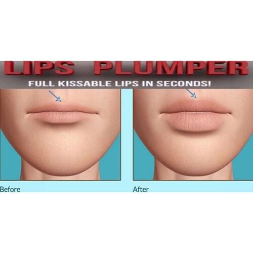 BRADYEXPRESS Protective Lip Balms