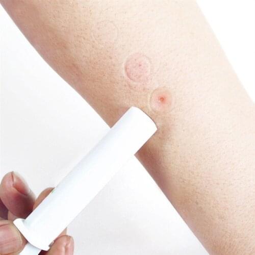 Mosquito Bites Extraction Vacuum Pump Reduce The Itching Swelling First Aid Accessories Snake Venom Extraction Vacuum Pump Tool