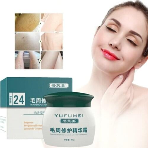 50g Curing Keratosis Pilaris/ Kp/ Chicken Skin Body Lotion Skin Repair Cream Skin Care Essence Moisturizing And Nourishing