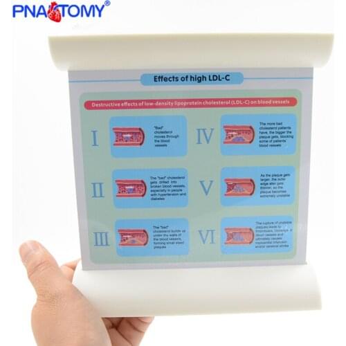 Blood Vessel Model Human Arteries Hyperlipidemia Medical Teaching Tool Anatomy Educational Equipment Anatomical Blood Cell