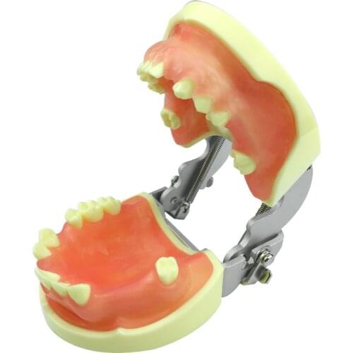 Dentistry Practice Implant Teeth Model for Dental Students Practice Incision and Suturing Dental Teaching Model