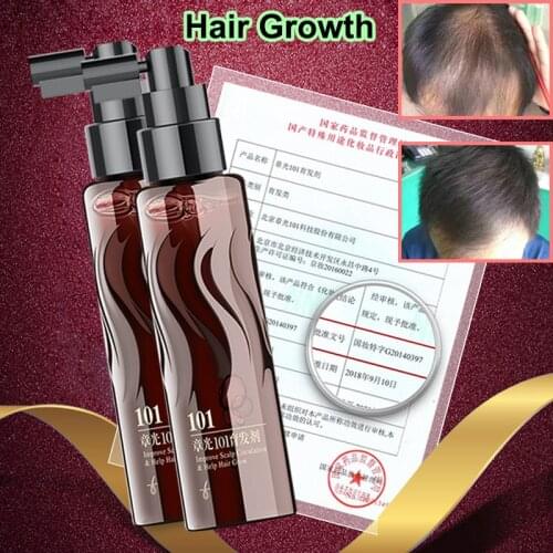 World famous Zhang Guang 101 formula 2x120ml Chinese medicine therapy anti hair loss hair care nourish the hair regrowth