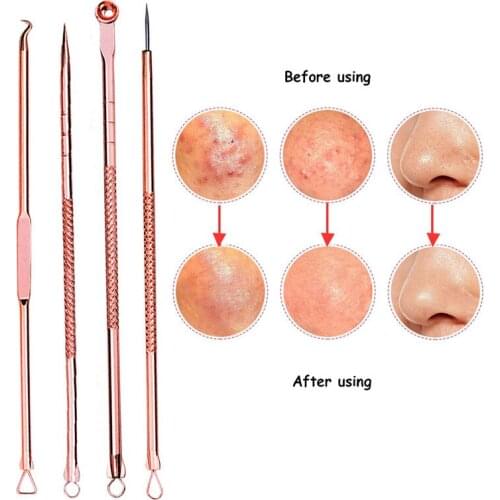 Efero 4Pcs Double-Ended Stainless Steel Blackhead Pimples Acne Needle Rose Gold Acne Extractor Remover Tool Skin Care
