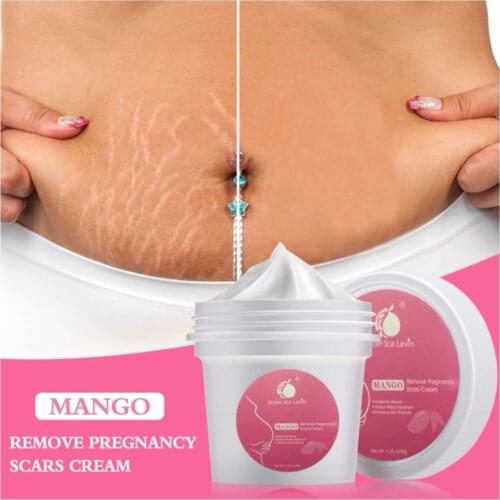 Body Cream Stretch Mark Cream Lighten Prevent Stretch Marks Postpartum Repair Cream Moisturizer Body Cream maquiagem