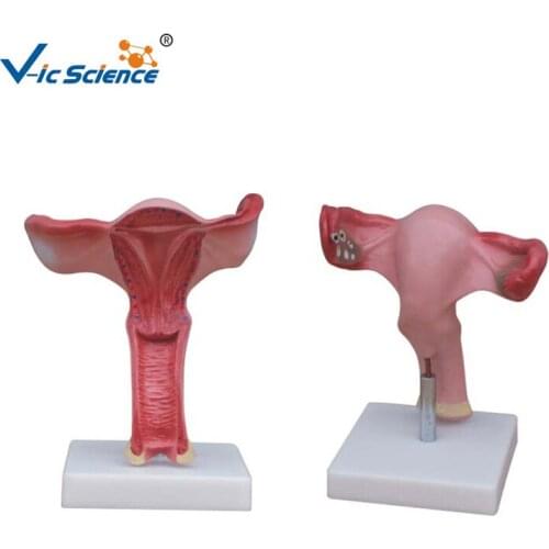 Advanced PVC Made Magnified Uterus Enlarged Model
