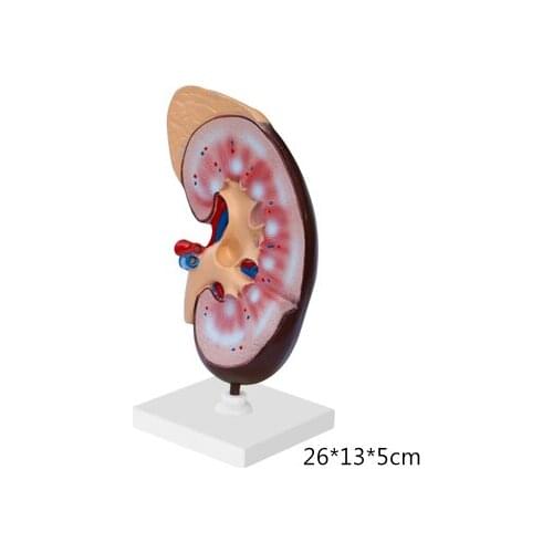Kidney model biological human organ anatomical model teaching
