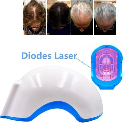 Hair Growth Devices Laser Helmet 80/272pcs Light Chips Hair Regrowth Hat Rechargeable Hair Promoter Regrow Fast Treatment Cap