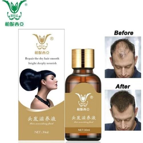 Fast Powerful Hair Care Hair Growth Essential Oils Faster Regrowth HairLoss Liquid Preventing Liquid Repair Health Treatment 30g