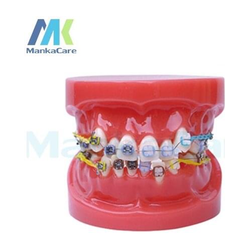 Manka Care -24pcs Tooth , half metal&half ceramic bracket Oral Model Teeth Tooth Model
