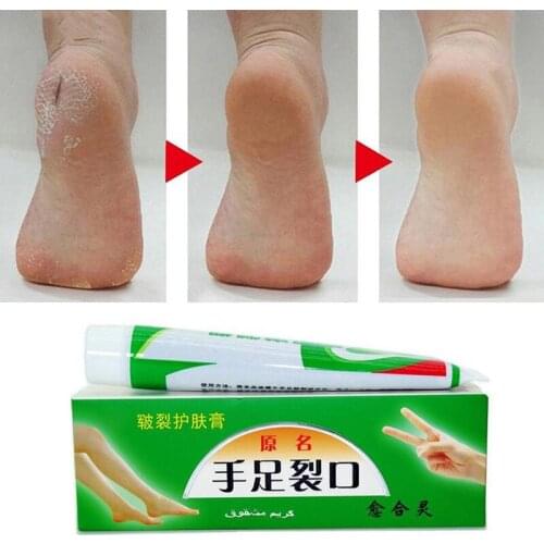 2019 Hand Foot Crack Cream Heel Chapped Peeling Repair Anti Dry Crack Winter Feet Care Ointment