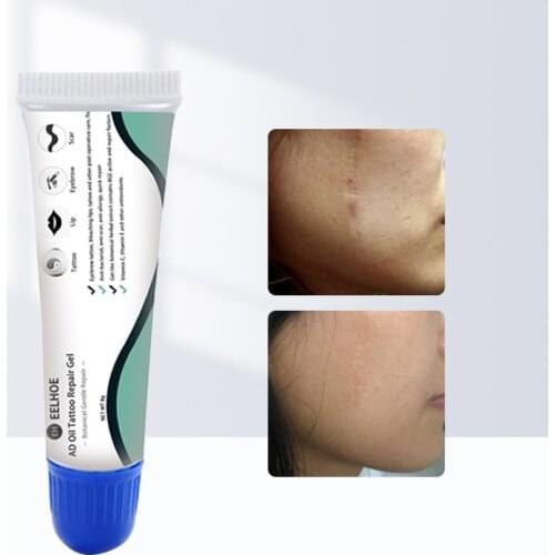 Scar Removal Cream Face Cream For Face Acne Scar Stretch Marks Remover Cream Skin Repair Face Cream Acne Spots 8g