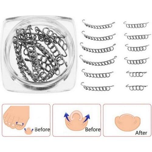 1 box Paronychia File Patch Wire Remover Toe Nail Correction Nail Art Ingrown Toenails Care Relief Pain Foot Pedicure Tool