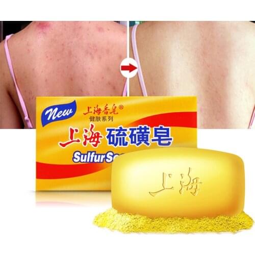 85g/125g Anti Fungus 4 Skin Conditions Seborrhea Eczema Perfume Butter Bubble Bath 85g Shanghai Sulfur Soap Acne Psoriasis