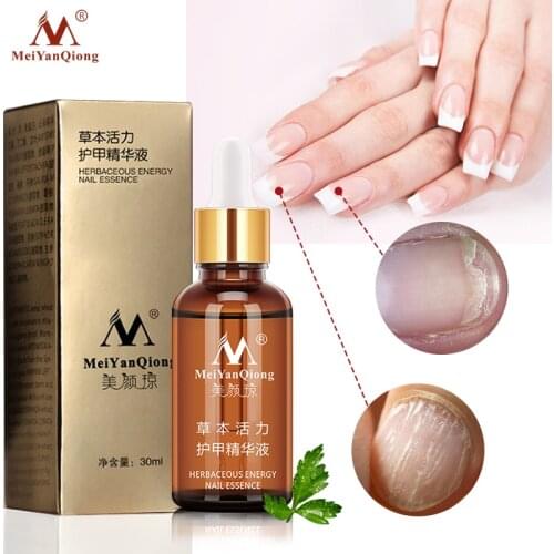 MeiYanQiong Nail Treatment Feet Care Essence Nail Foot Whitening Toe Nail Fungus Anti Fungal Nail Infection Good Toenail 30ml