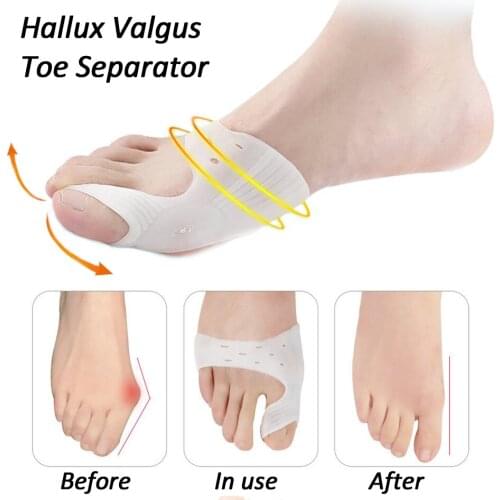 2Pcs Silicone Hallux Valgus Toe Separator Silicone Insoles Toe Overlapping Pain Relieve Spreader Foot Protector Inserts Orthosis