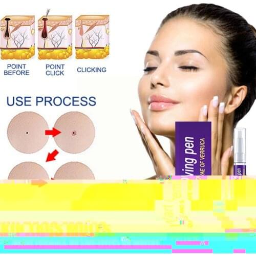 100% Quality Skin Tag Genital Wart Remover Pen Warts Against Liquid From Anti Produc Remover Foot Skin Removing Tag Callus I3U7