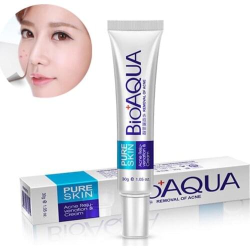 Bioaqua Acne Treatment Blackhead Remova Anti Acne Cream Oil Control Shrink Pores Acne Scar Remove Face Care Whitening
