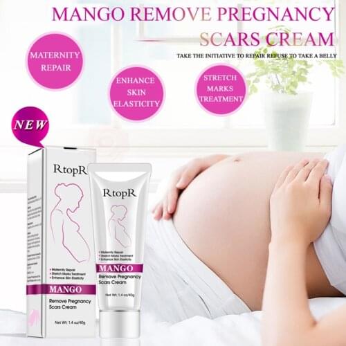 Hot 40g Stretch Mark Repair Cream Pregnancy Scars Removal Body Skin Care for Pregnant Maternity SK88