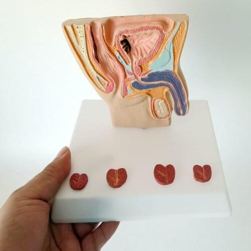 Human male prostate anatomy male genitals abdominal cavity anatomy testis bladder bowel teaching instrument for human body