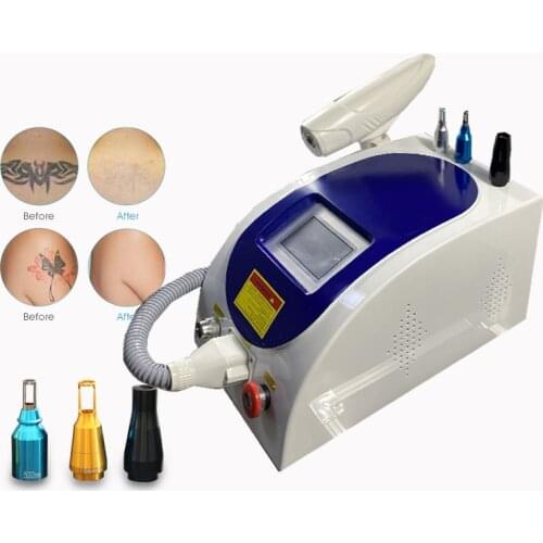 Laser Tattoo Removal Machine Price Portable 1064 532nm Q Switched Nd Yag Laser