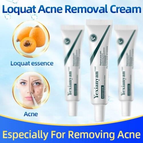 Loquat Repair Acne Cream Improve Blackheads Marks Anti Acne Removal Of Whitening Cream Refreshing And Gentle