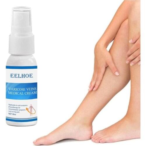 30g Varicose Vein Soothing Spray Effectively Relieve Varicose Veins And Leg Swelling Varicose Veins Treatment Spray Cream