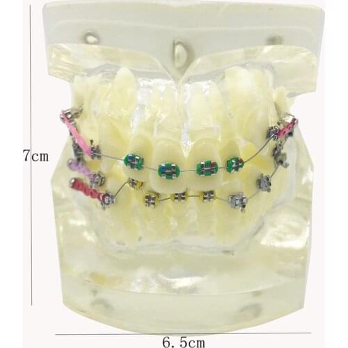 Wrong jaw correction tooth model M3005/Dental Orthodontic teeth model/Fault Correction Tooth model With ligature