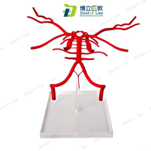Human Brian Basilar Artery Anatomy Model for Ideal of Student and Patient Teaching
