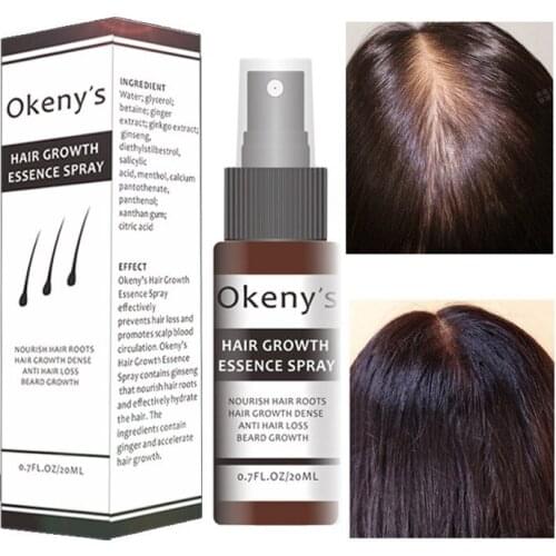 Hair Growth Essence Spray Growth oil preventing baldness Anti hair loss nourishing care enhances hair roots