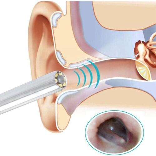 Ear Cleaning Endoscope Spoon Mini Camera Ear Picker Support Earwax Ear Wax Cleaner Removal PC Tool Visual Android Ear O1G0
