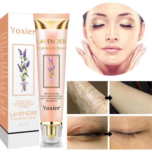 Yoxier Repair Scar Cream Acne Scar Stretch Marks Repair Cream Pigmentation Corrector Anti-allergic Calm Whitening Skin Care