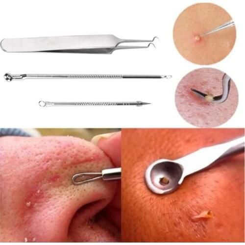 3Pcs Black Dot Pimple Blackhead Remover Tool Needles set For Squeezing Acne Tools Spoon for Face Cleaning Extractor Por