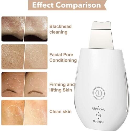Ultrasonic EMS Vibrate Deep Face Cleaning Skin Scrubber Remove Dirt Blackhead Reduce Wrinkles Facial Lifting Peeling Tool