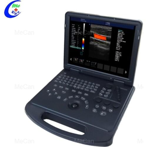 MCB-C60 15inch 3D 4D Laptop Color Doppler Portable Ultrasound Scanner