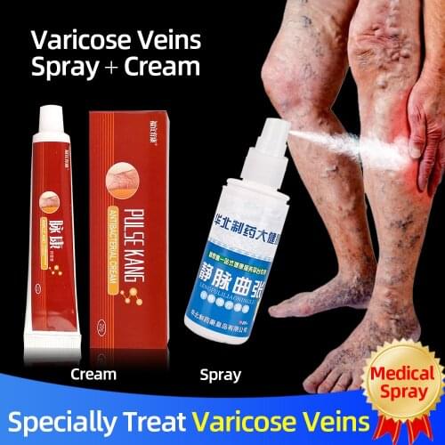 Varicose Veins Treatment Spray Varicosity Repair Cream Varicocele Remove Relief Pain Phlebitis legs Varicose Veins Health Care