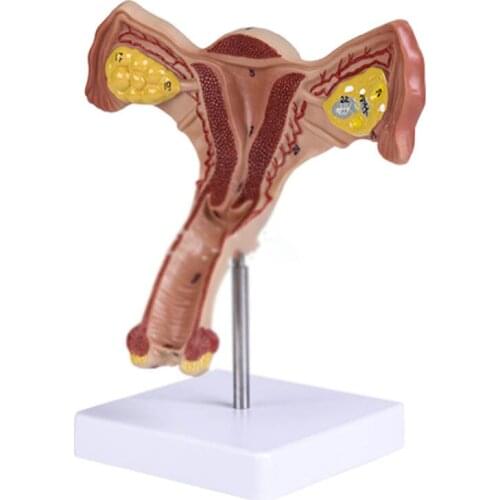 The anatomical structure of the uterus in obstetrics and gynecology simulates the pathological uterine model