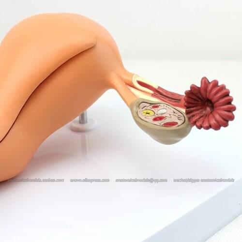 CMAM/12442 Female Genital System Uterus Ovary, Genitourinary Medical Teaching Anatomical Model