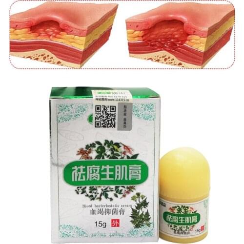 Herbal Removal Rot Myogenic Cream Bedsores Paste Treat Pressure Sores/Decubituses/Pressure Ulcer Festering Wound Healing