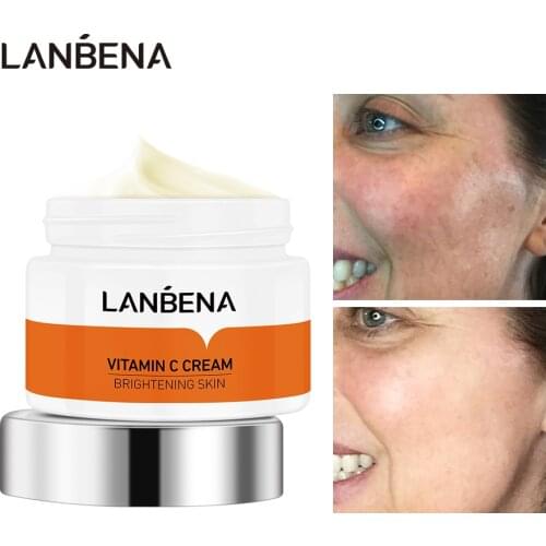 LANBENA Face Cream VC Whitening Nourish Brighten Remove Freckle Improving Fine Lines Dull Skin Anti Aging Refreshing Not Greasy