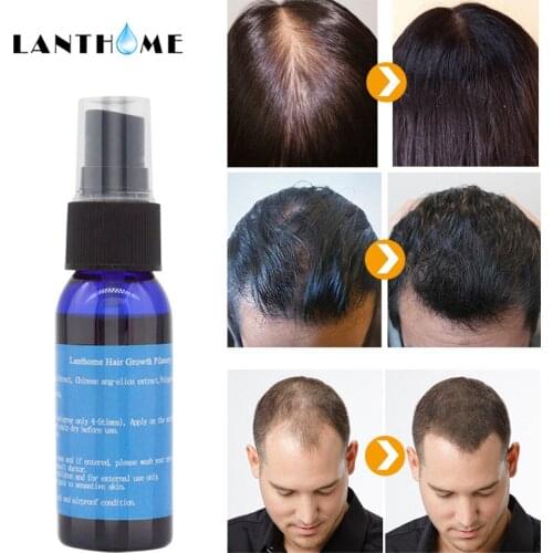 Baldness Serum and Argan Oil and Castor Oil Hair Growth Essence 3PCS set can repair dry damage and prevent hair loss