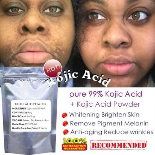 Pure 99% Kojic Acid Powder Face Care Whitening Skin Cream Remove Freckle Melasma Acne Spots Pigment Sunburn Melanin 20g