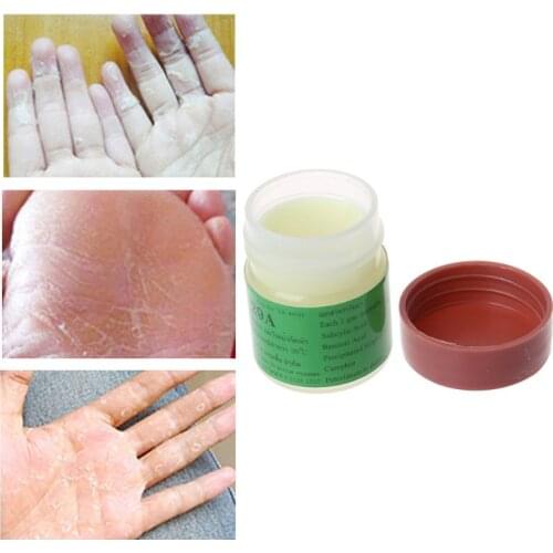7.5g Nature Antimicrobial Anti Fungal Cream Works Really Well for Psoriasi Eczma Foot Leg Skin Care Cream