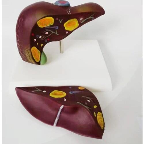 Medical human liver Model liver Anatomical Model Anatomy Liver structure model Medical teaching Aids school teaching supplies