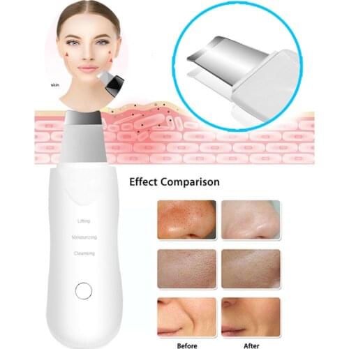 Skin Scrubber Facial Cleaner Skin Peeling Blackhead Removal Pore Cleaner Lift Machine Skin Care Face Cleaning Beauty Instrument