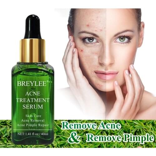 BREYLEE Acne Treatment Serum Face Anti Acne Pimple Removal Essence Cream Spots Oil Control Shrink Pores Moisturizing Skin Care