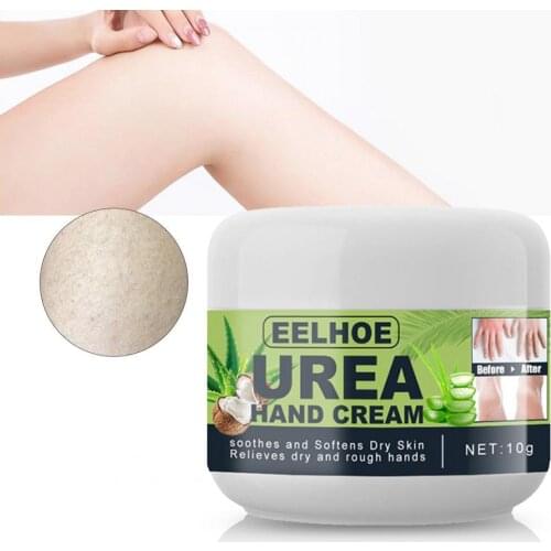 10g/20g/30g/50g Nail Treatment Cream Soft Smell-less Reusable Urea Skin Hand Cream for Winter