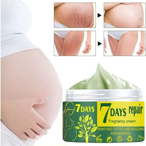 1pcs Pregnancy Marks Repairing Body Cream Stretch Mark Obesity Scar Removal Cream Moisturizing Firming Women Skin Care Lotion