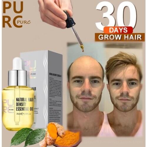PURC New Fast Growing Hair Oil Hair Growth Products Baldness Treatment Hair Loss Care Beauty Hairs Serum For Men Women 35ml