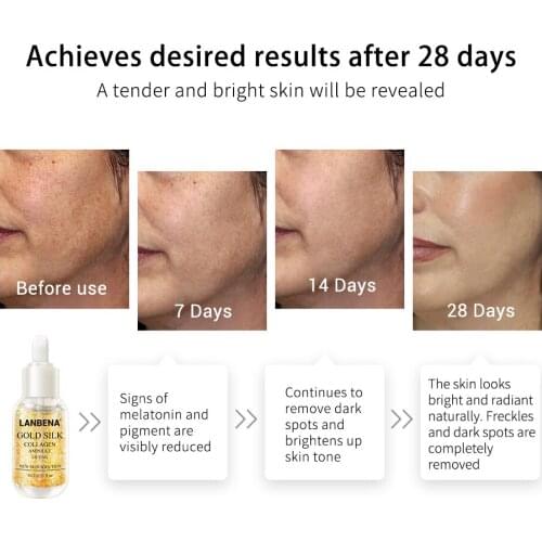 LANBENA Gold Silk Collagen Ampoule Serum Removes Melanin Lighten Dark Spots Whitening Firming Flexible Anti Aging Anti Wrinkle
