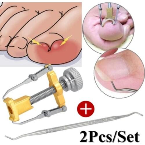 Ingrown Toenails Pedicure Foot Care Tool Nail Correction Clipper Cutters For Orthotic Acronyx Dead Skin Remover Podiatry